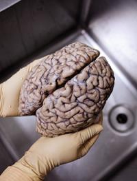 Gloved hands holding a preserved human brain.